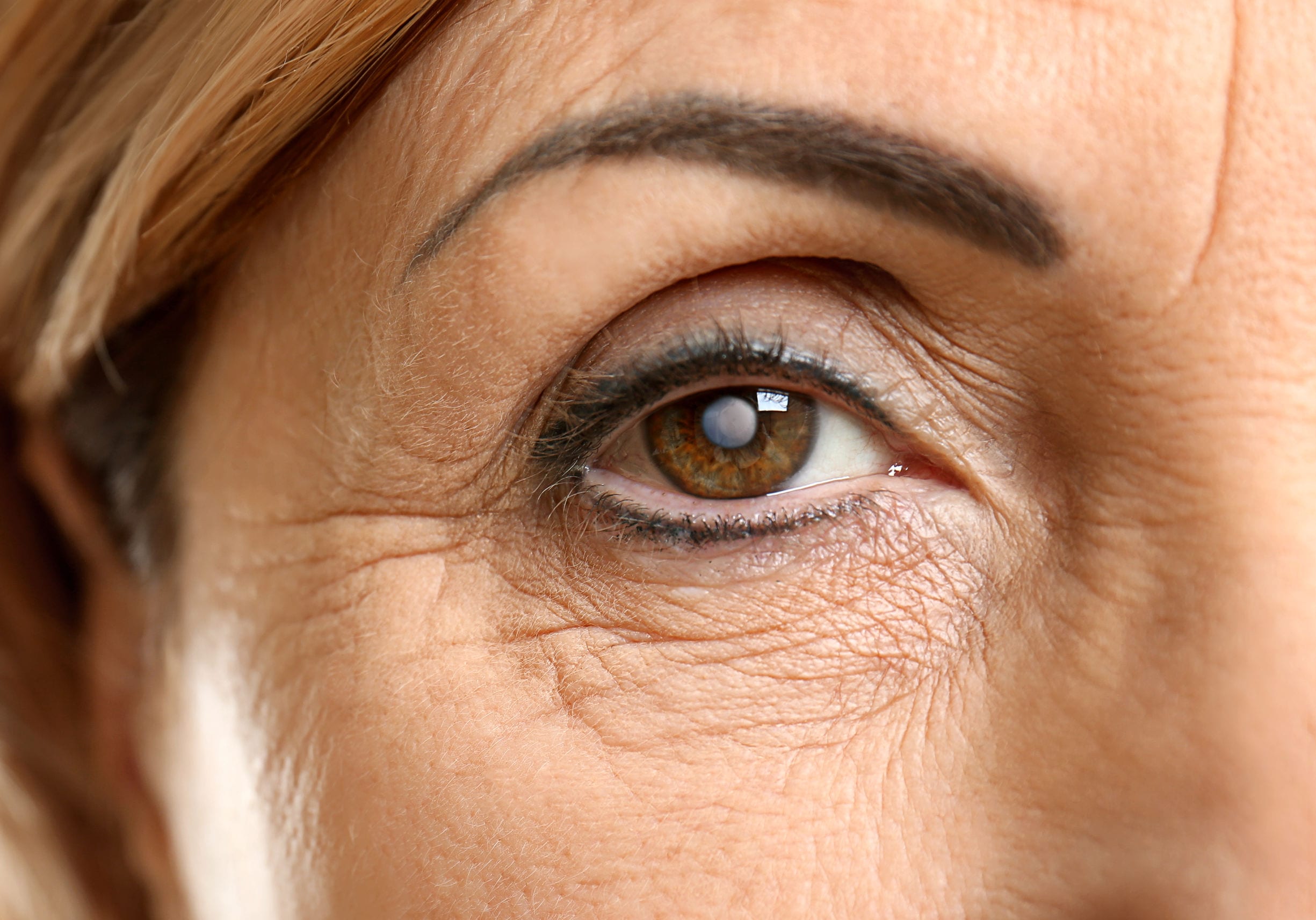Consultant ophthalmologist examines woman's cataract